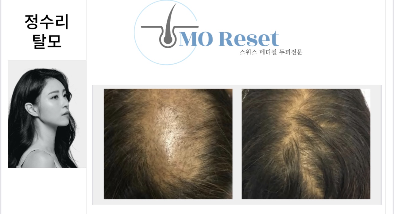 모리셋 당진점 대표 이미지