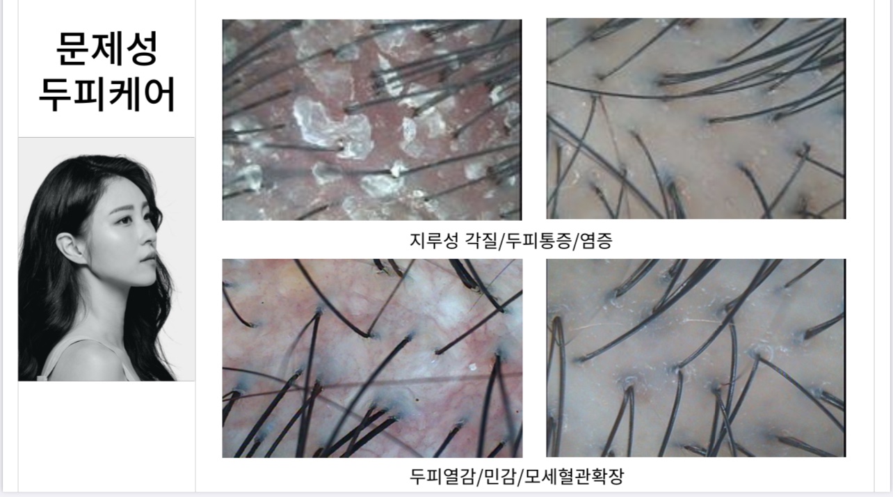 모리셋두피재생센터 당진점 대표 이미지