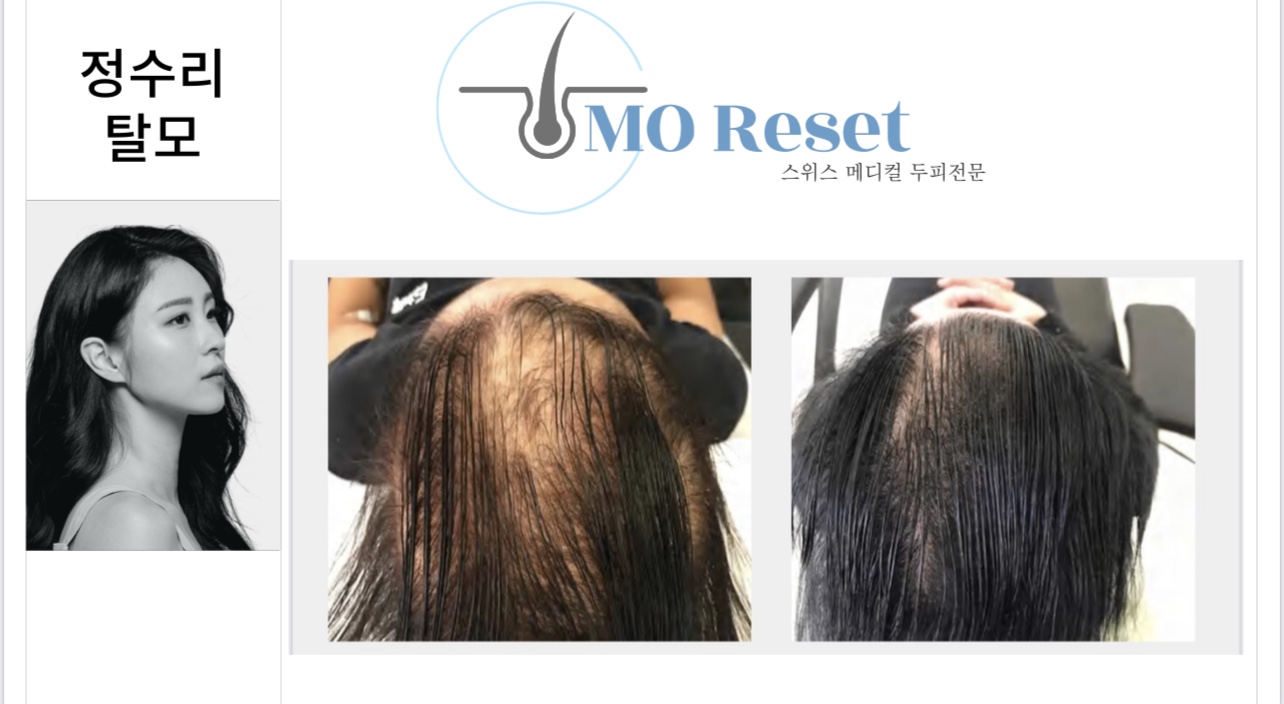모리셋두피재생센터 당진점 대표 이미지