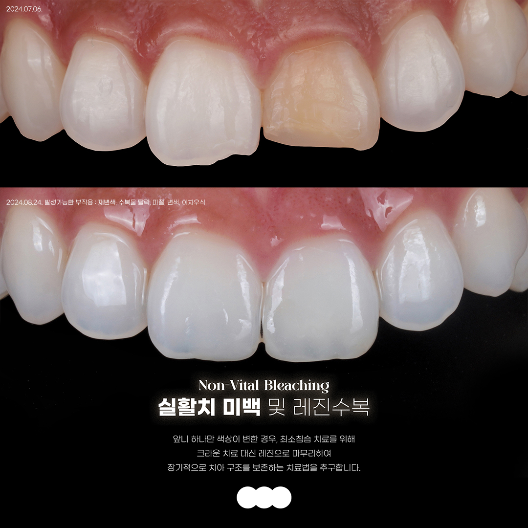 재주좋은치과의원 서초본원 대표 이미지