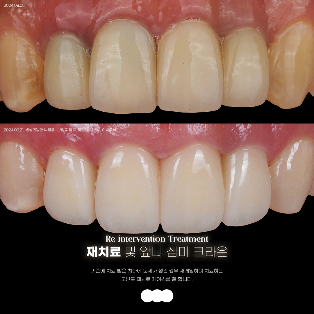 재주좋은치과의원 서초본원 대표 이미지
