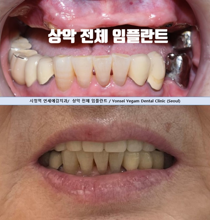 연세예감치과의원