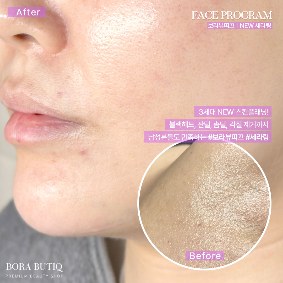 보라뷰띠끄 대표 이미지