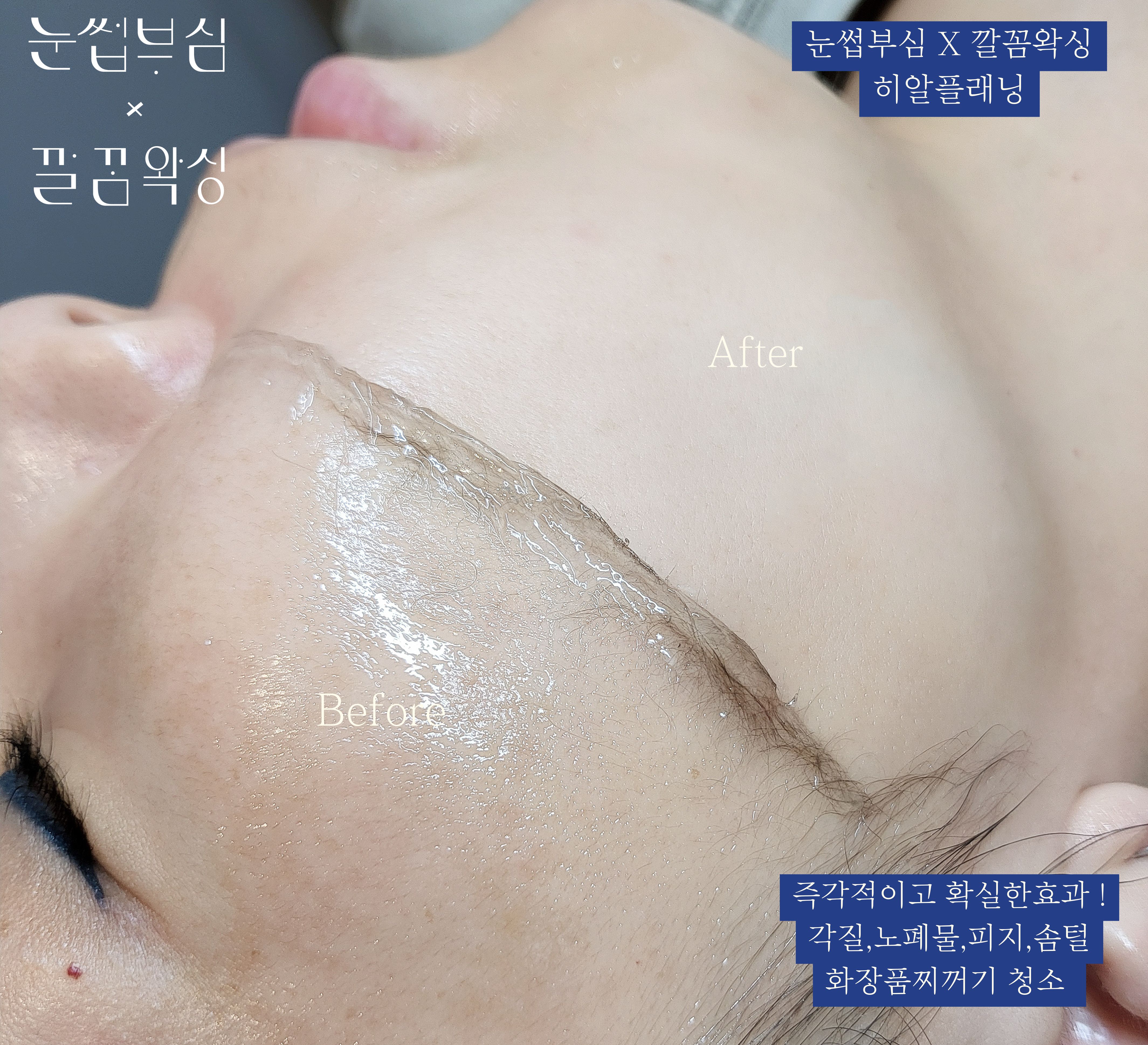 눈썹부심X깔꼼왁싱 대표 이미지
