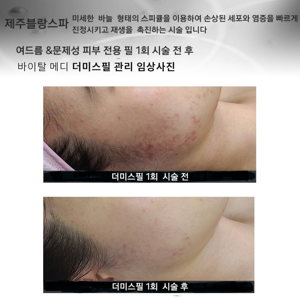 제주블랑스파 대표 이미지