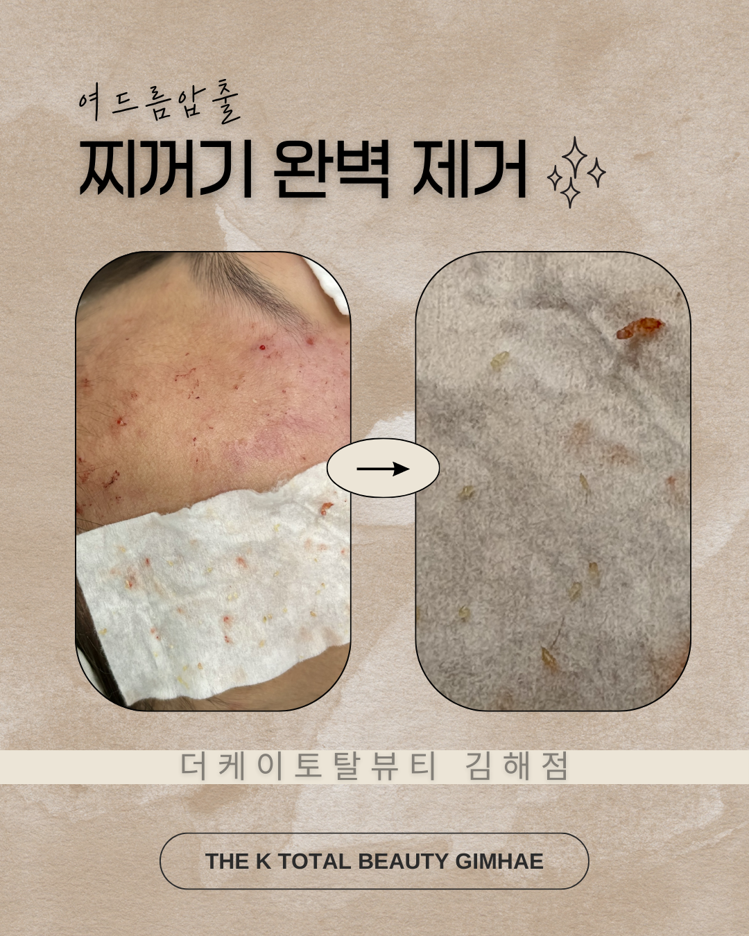 더케이토탈뷰티 김해점