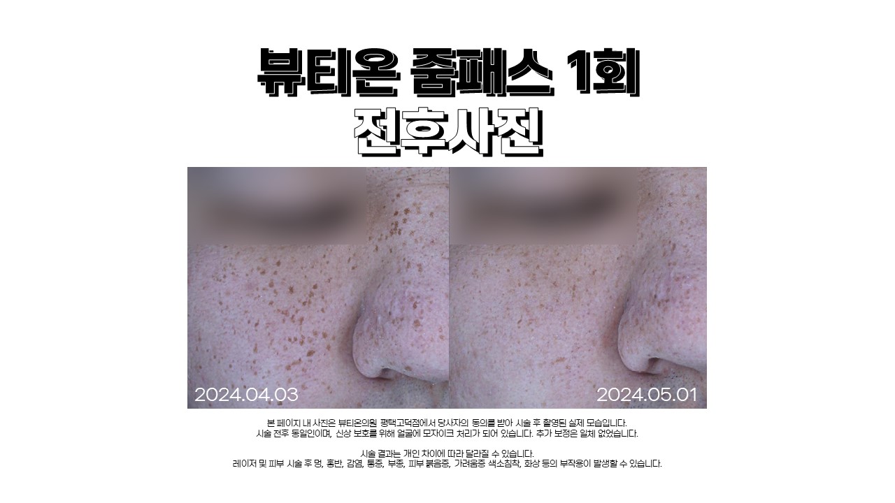 뷰티온의원 평택고덕점