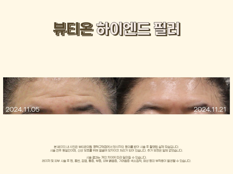 뷰티온의원 평택고덕점