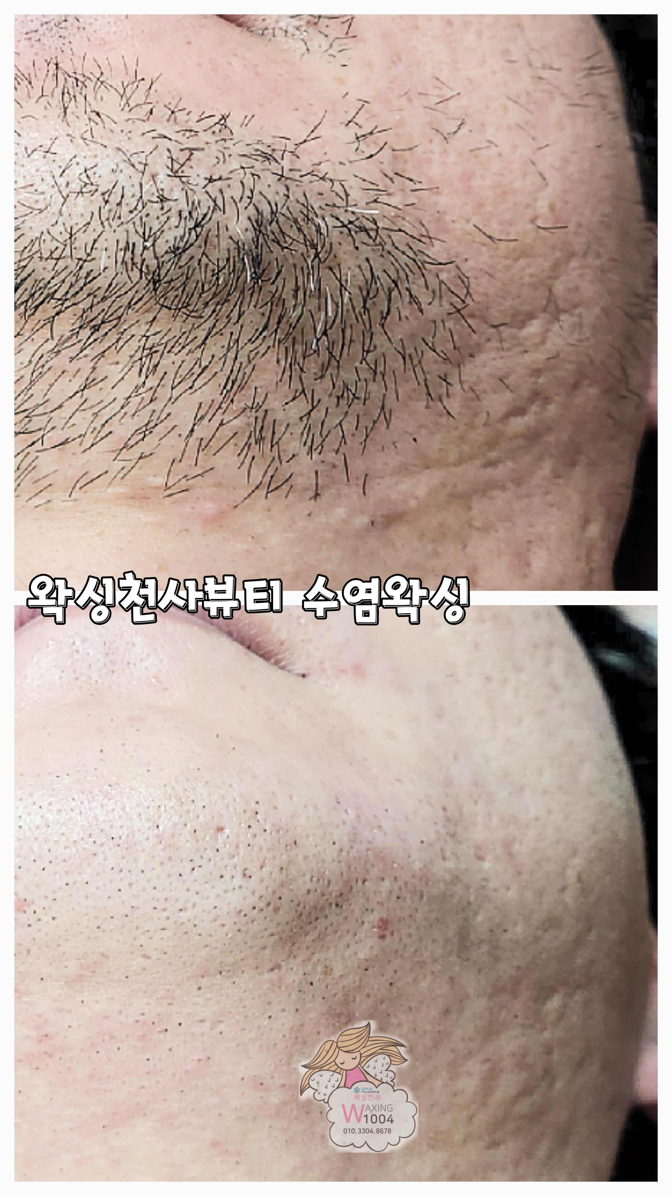 수원왁싱천사뷰티