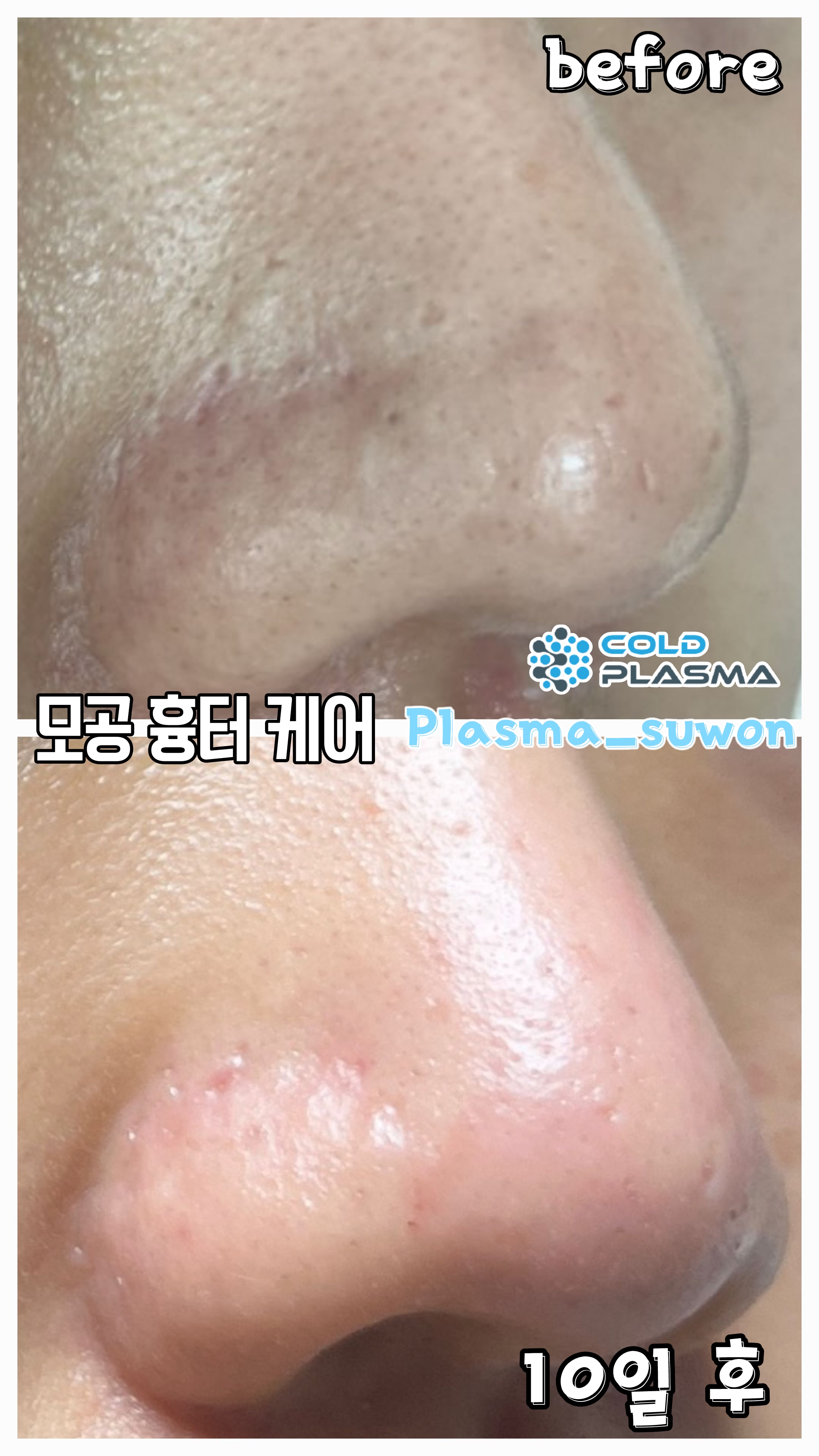 수원왁싱천사뷰티