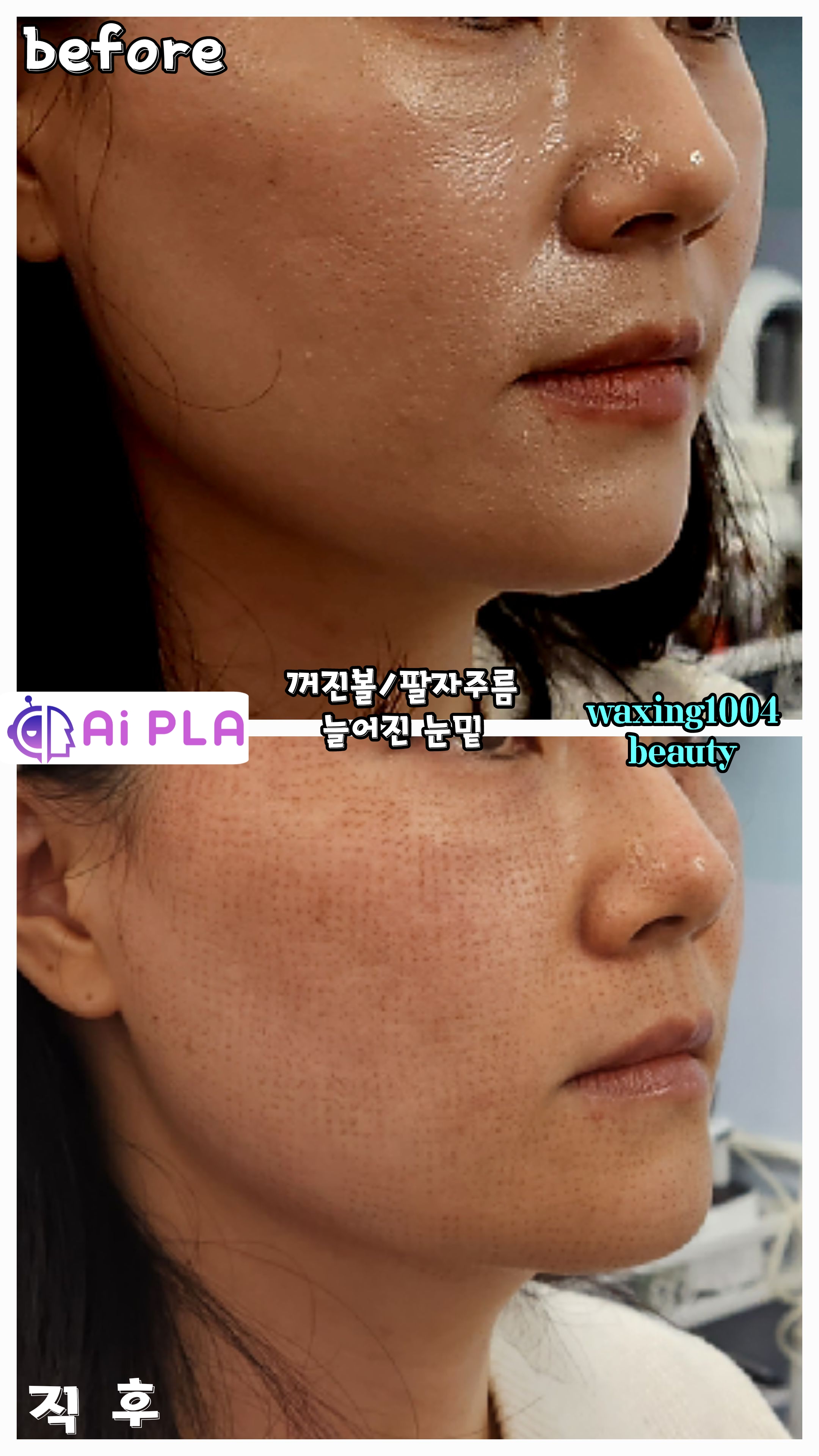 수원왁싱천사뷰티