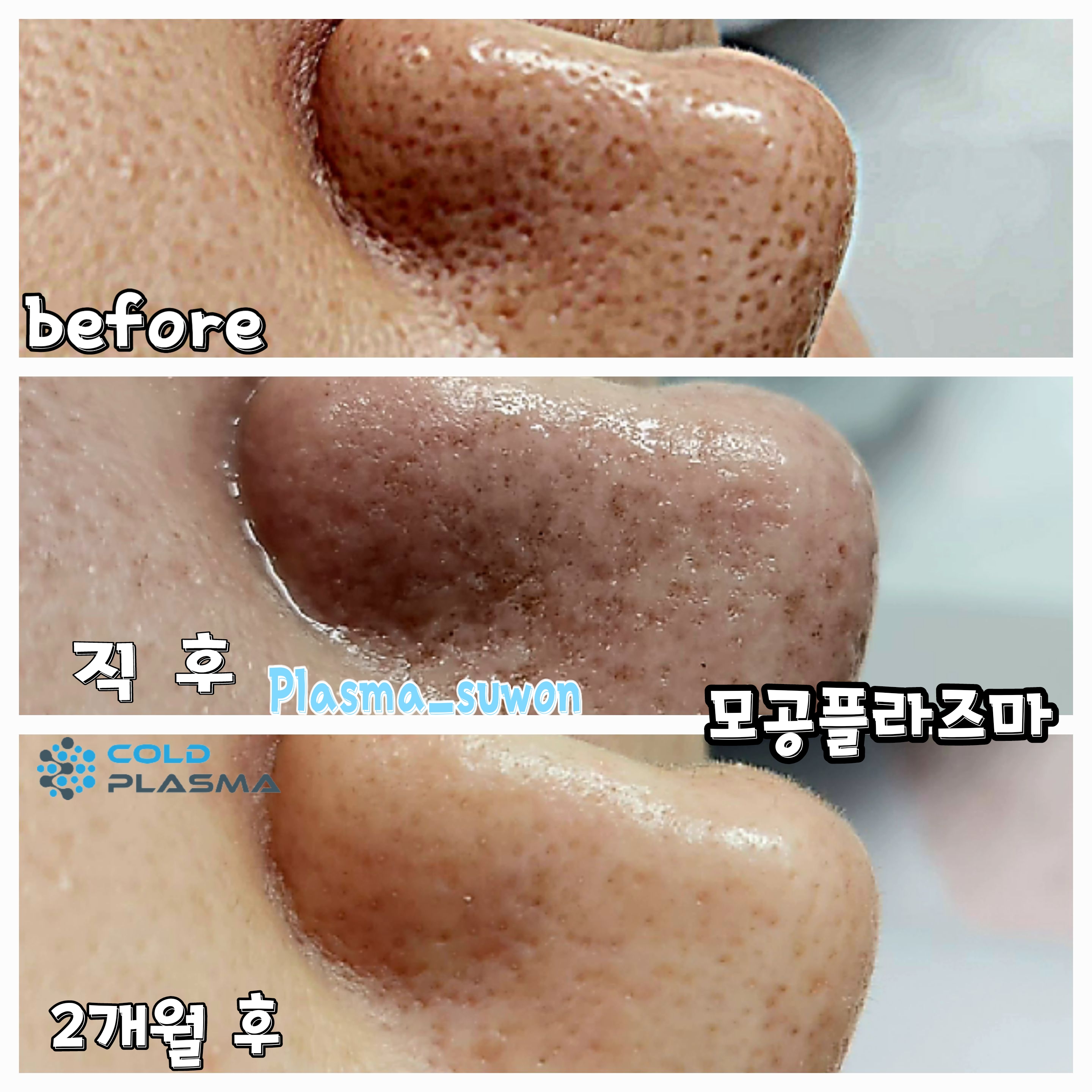 수원왁싱천사뷰티