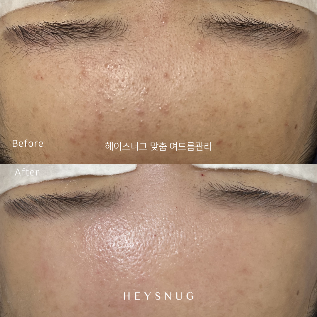 에스테틱 헤이스너그