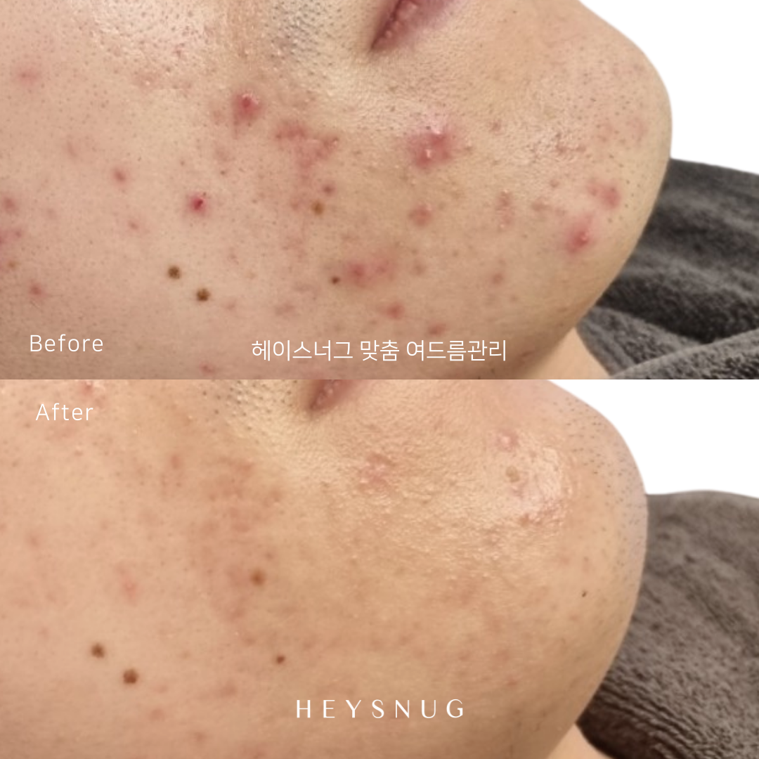 에스테틱 헤이스너그