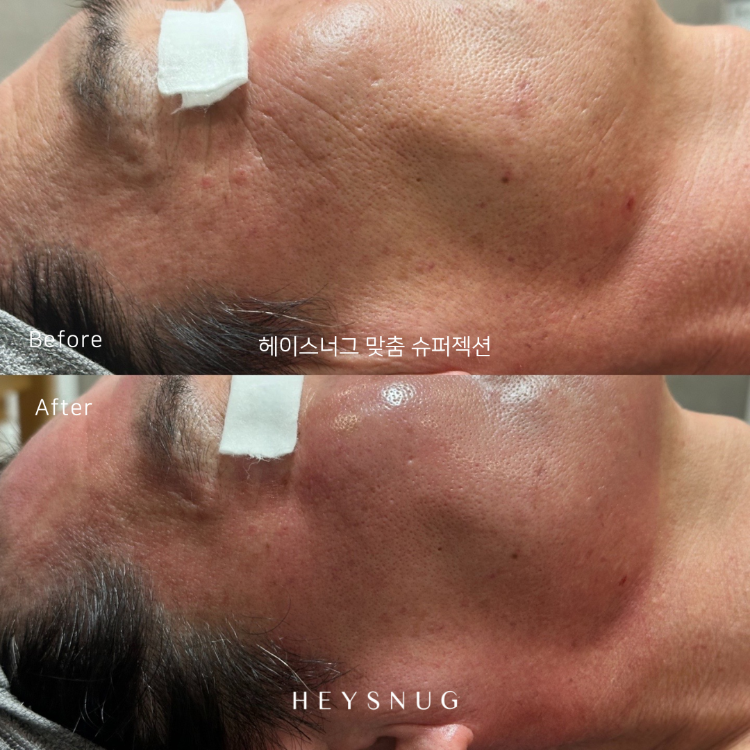 에스테틱 헤이스너그