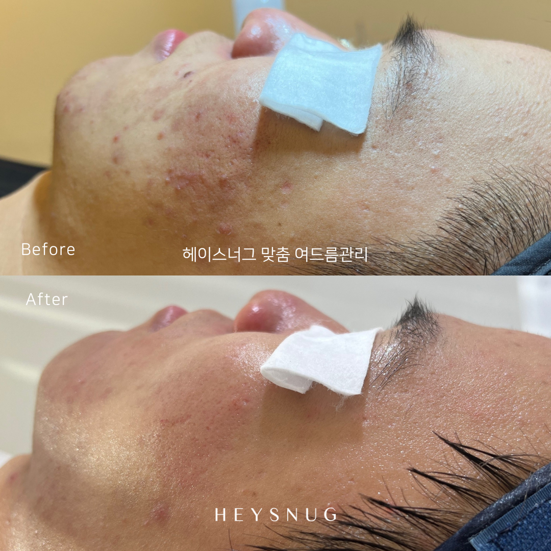 에스테틱 헤이스너그