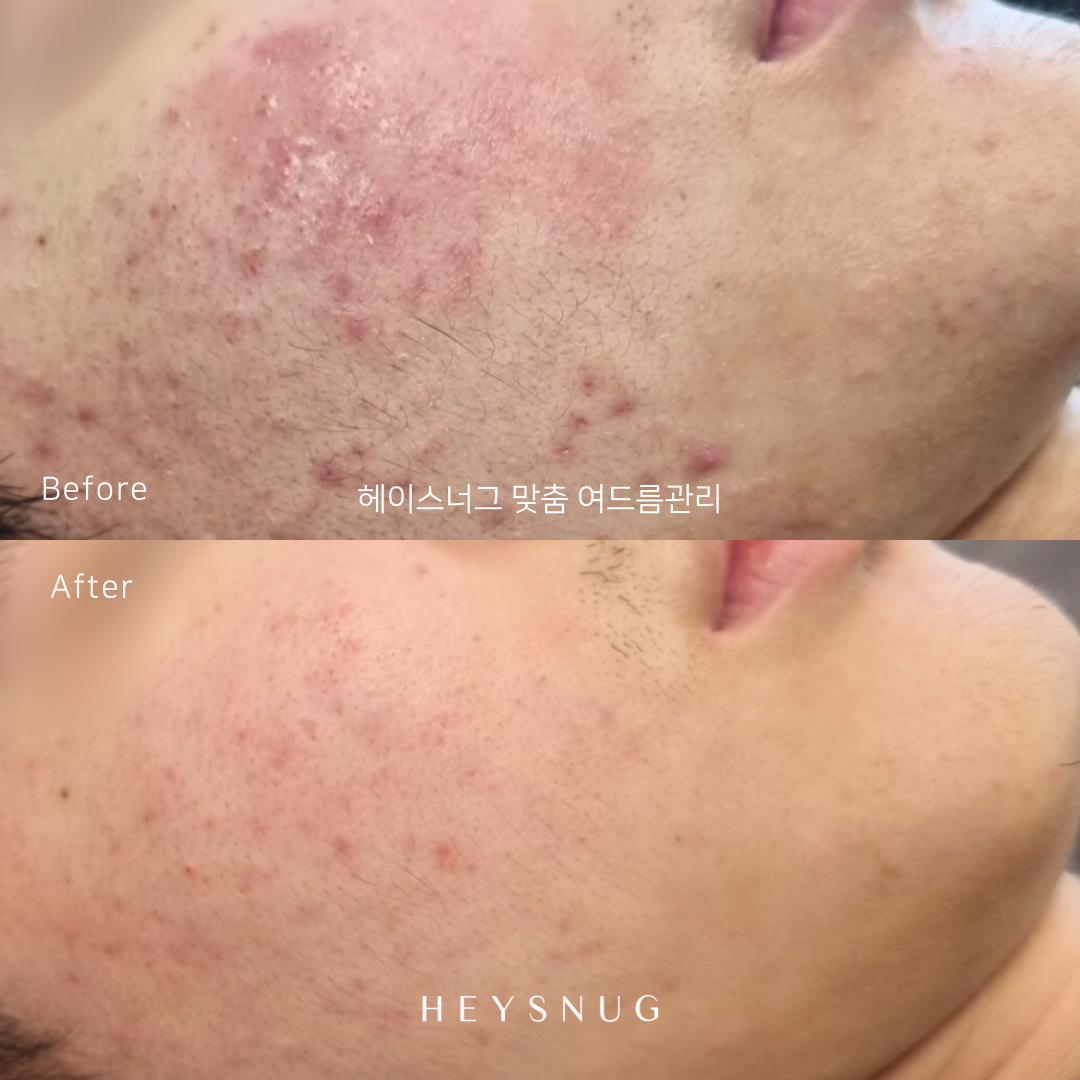 에스테틱 헤이스너그 대표 이미지