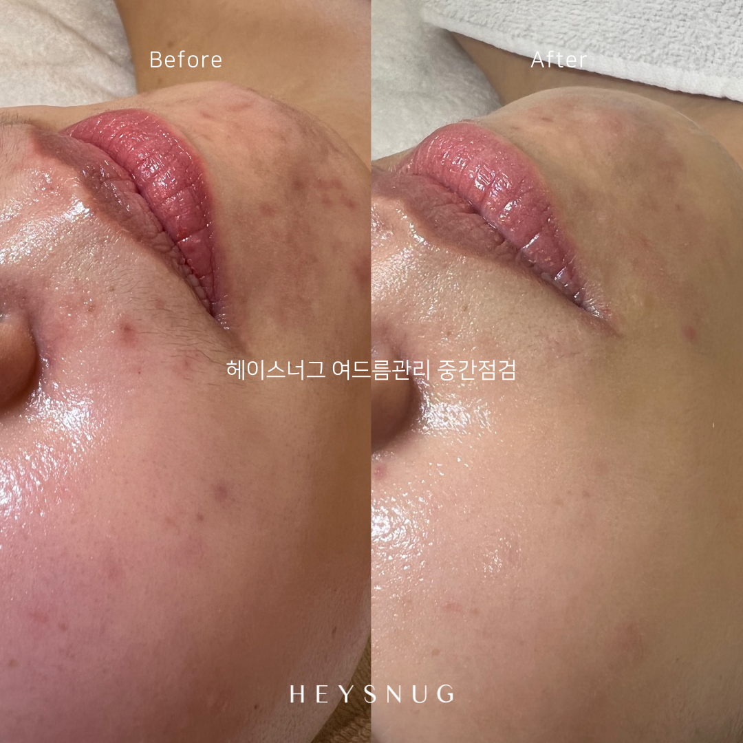 에스테틱 헤이스너그