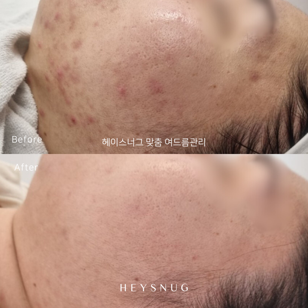에스테틱 헤이스너그 대표 이미지