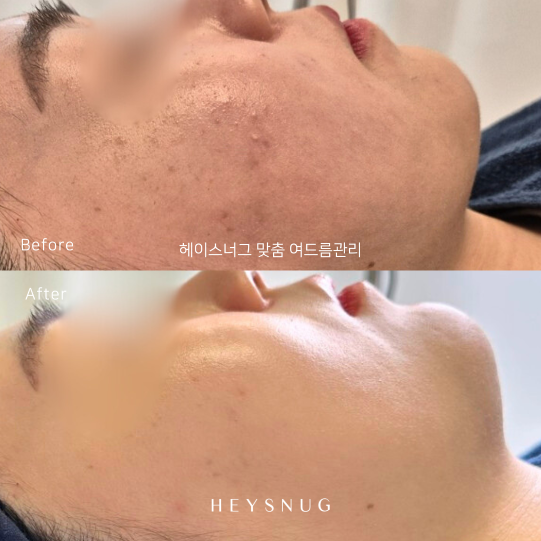 에스테틱 헤이스너그