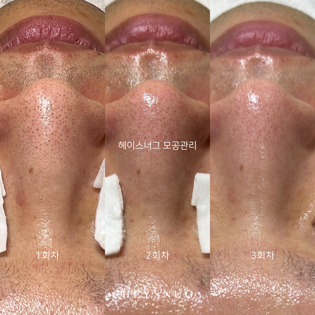 에스테틱 헤이스너그