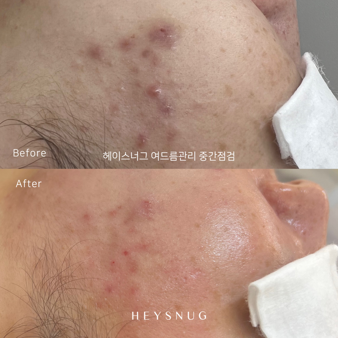 에스테틱 헤이스너그