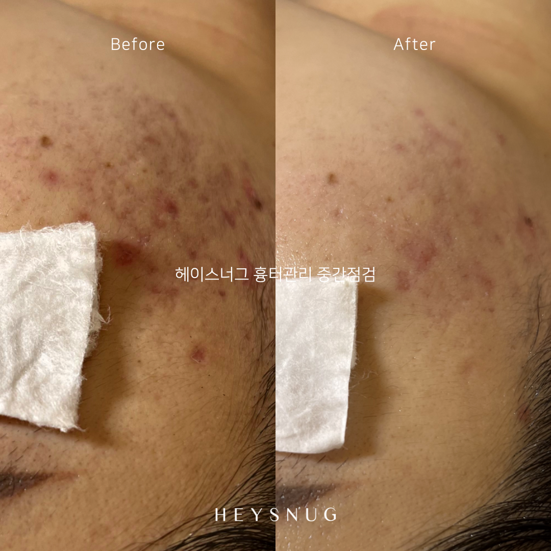 에스테틱 헤이스너그