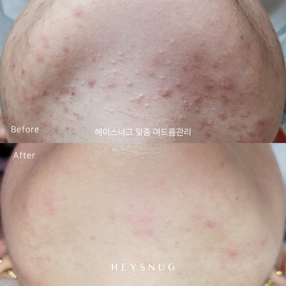 에스테틱 헤이스너그