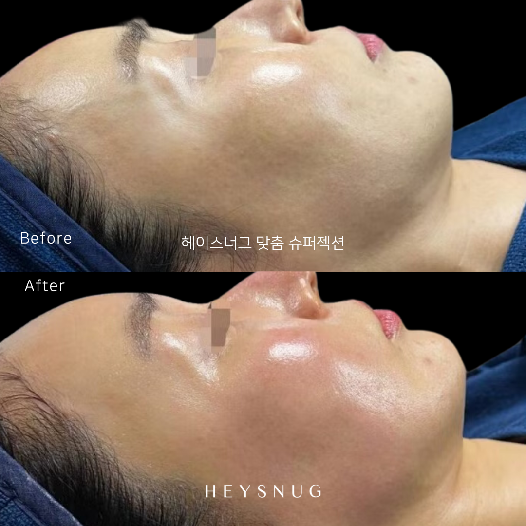 에스테틱 헤이스너그