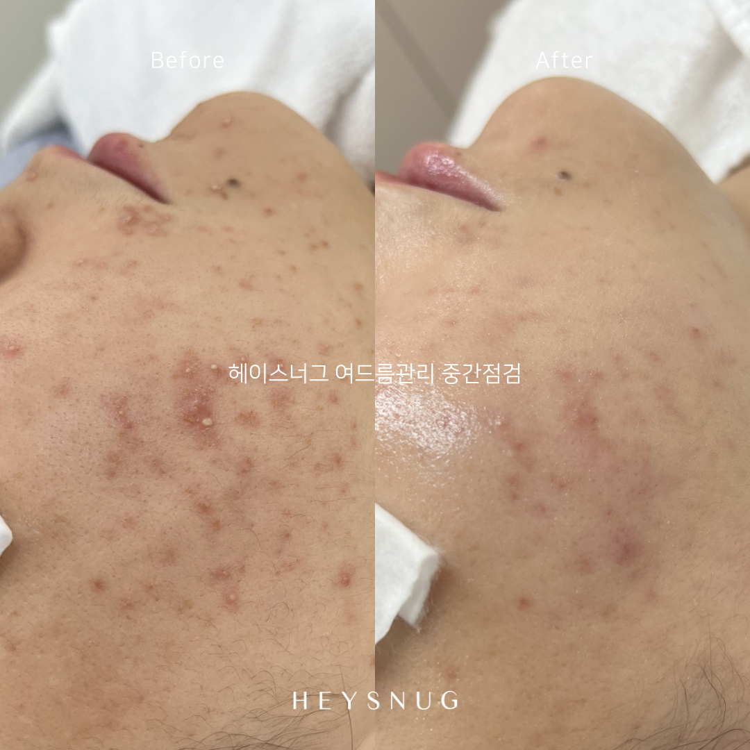 에스테틱 헤이스너그