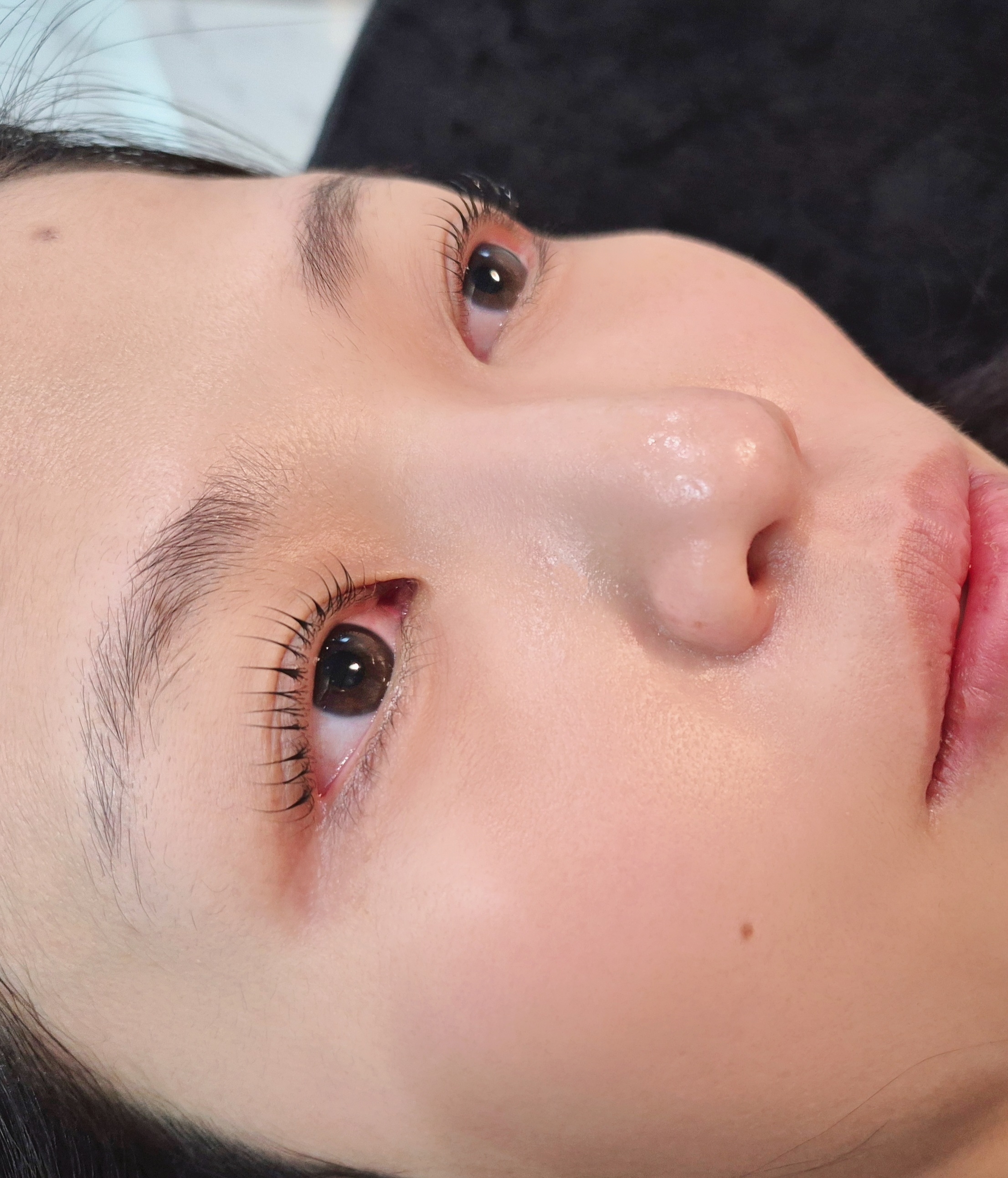 드니엘래쉬 대표 이미지