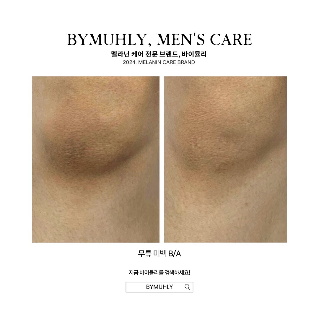 시숲 대표 이미지