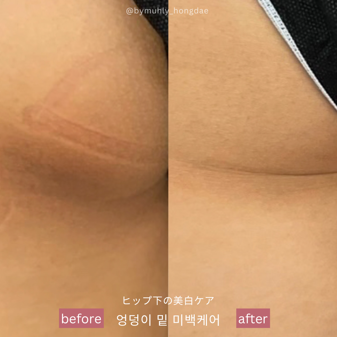 바이뮬리 브로우돌 홍대점 대표 이미지