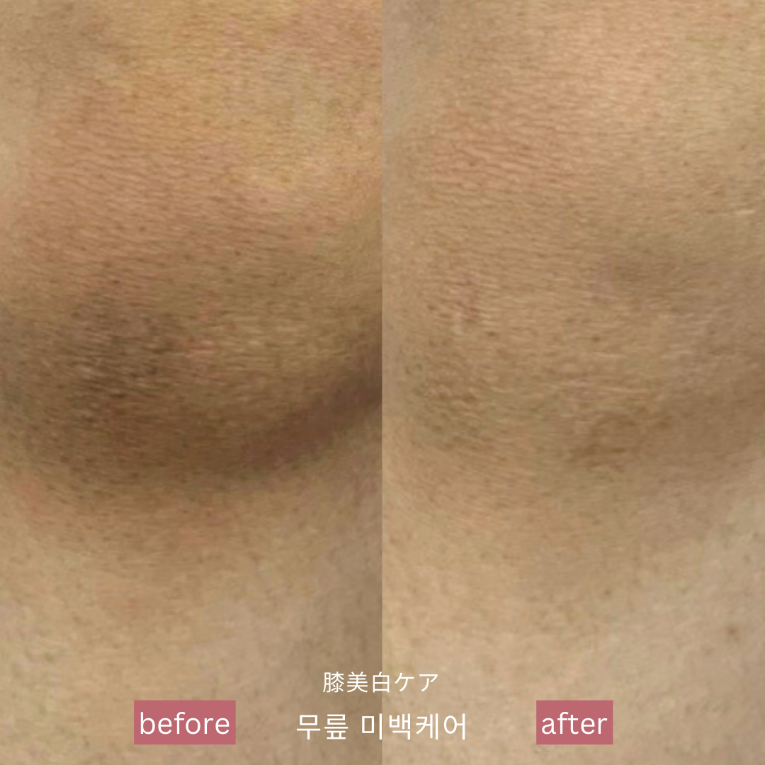 바이뮬리 브로우돌 홍대점 대표 이미지