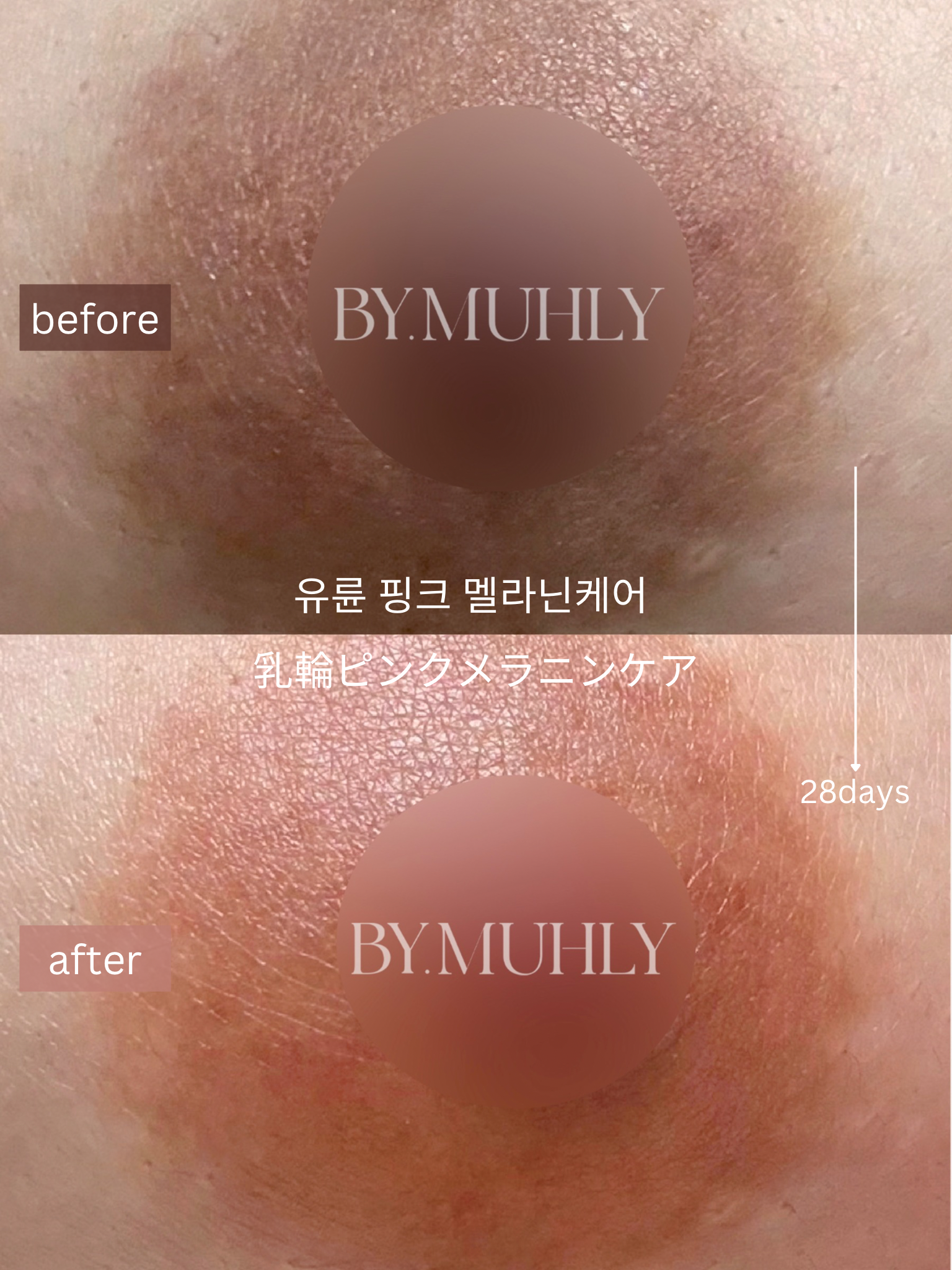 바이뮬리 대표 이미지