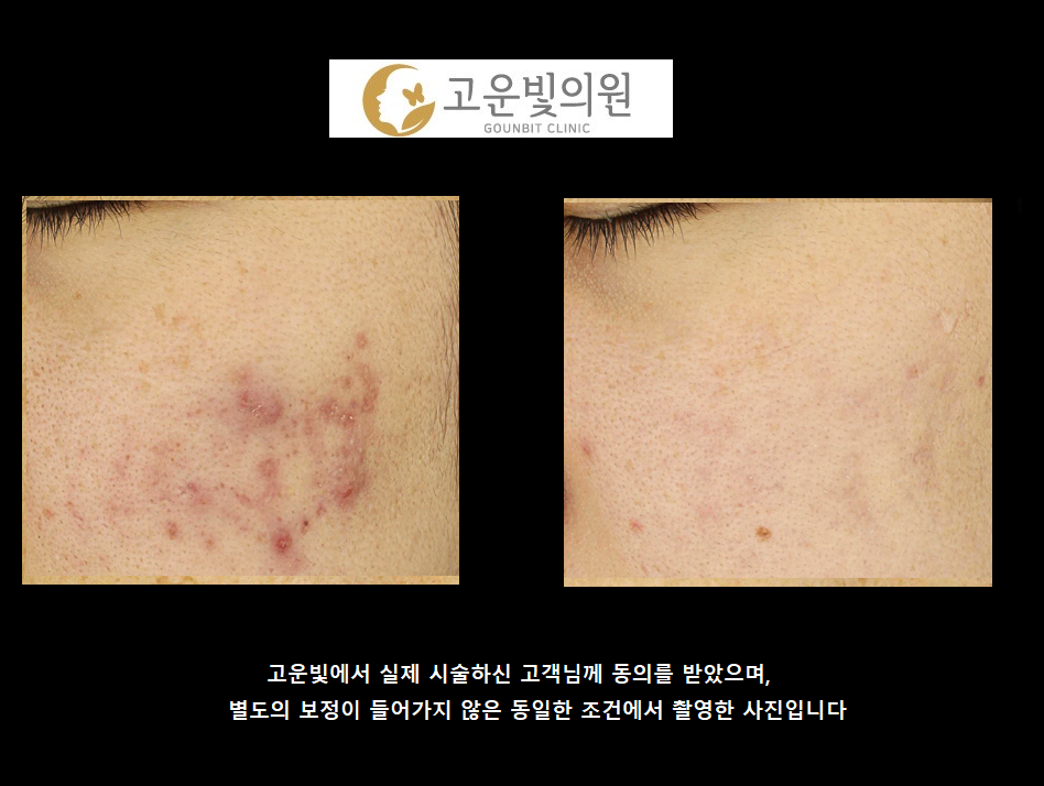 고운빛의원