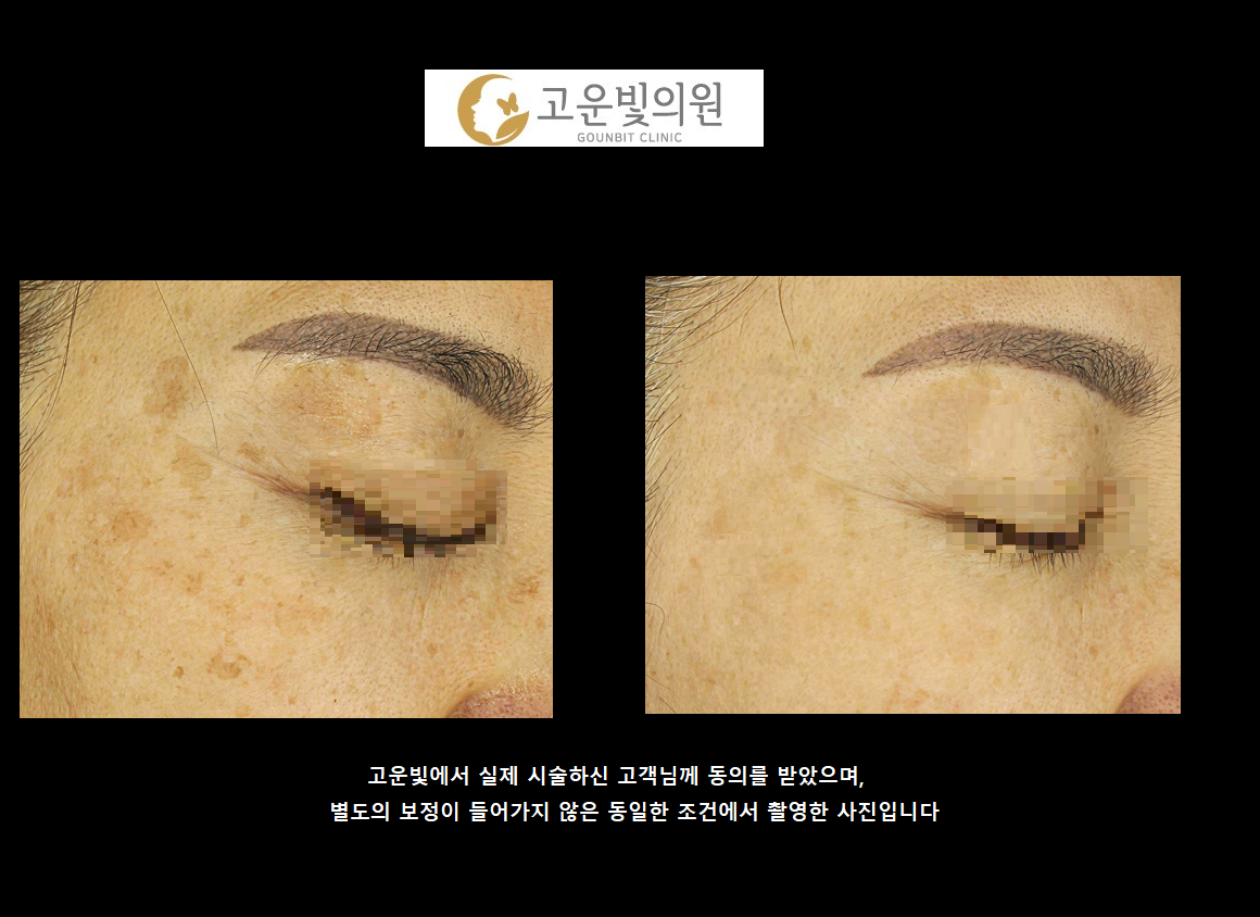 고운빛의원