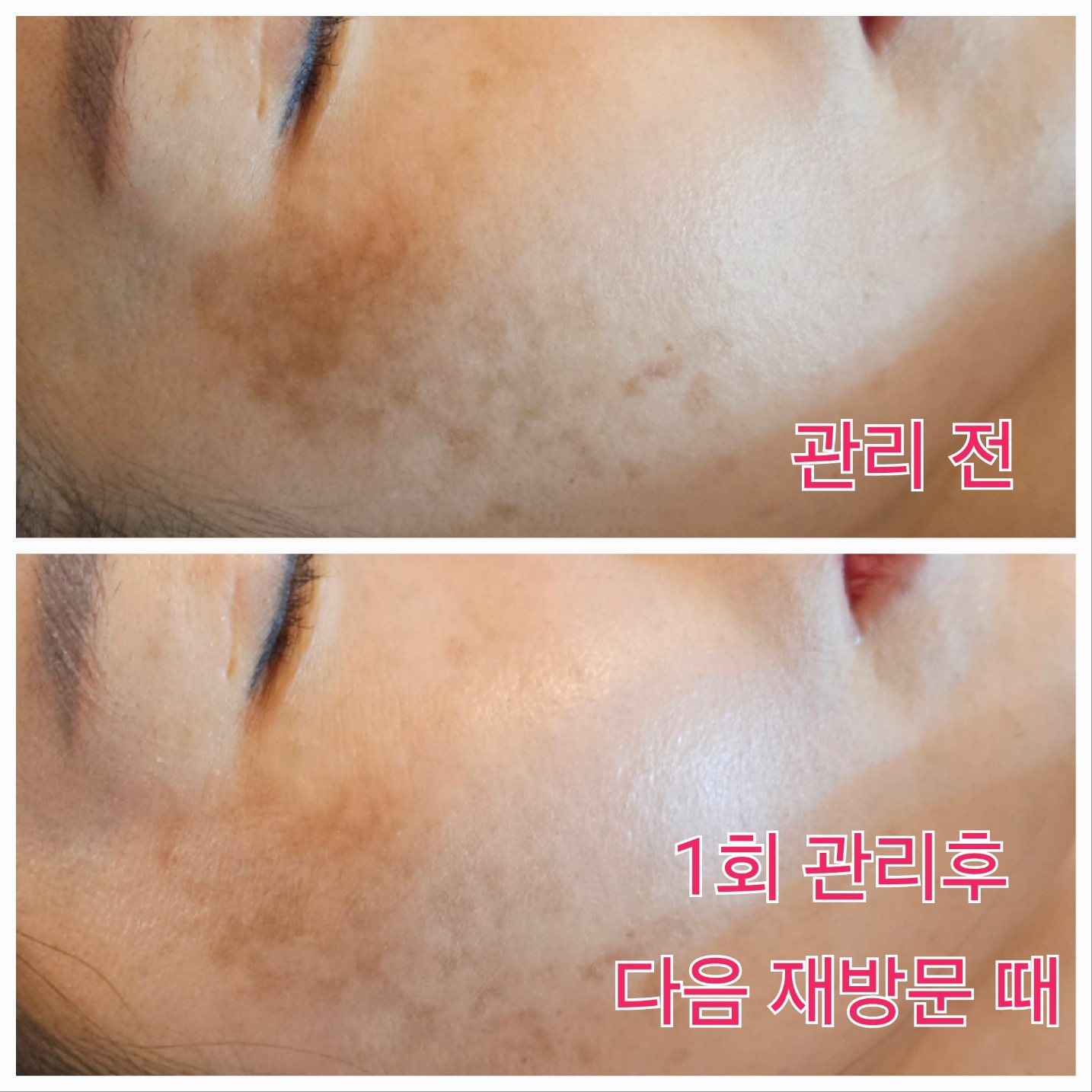 올가드림뷰티 건대입구자양점 대표 이미지