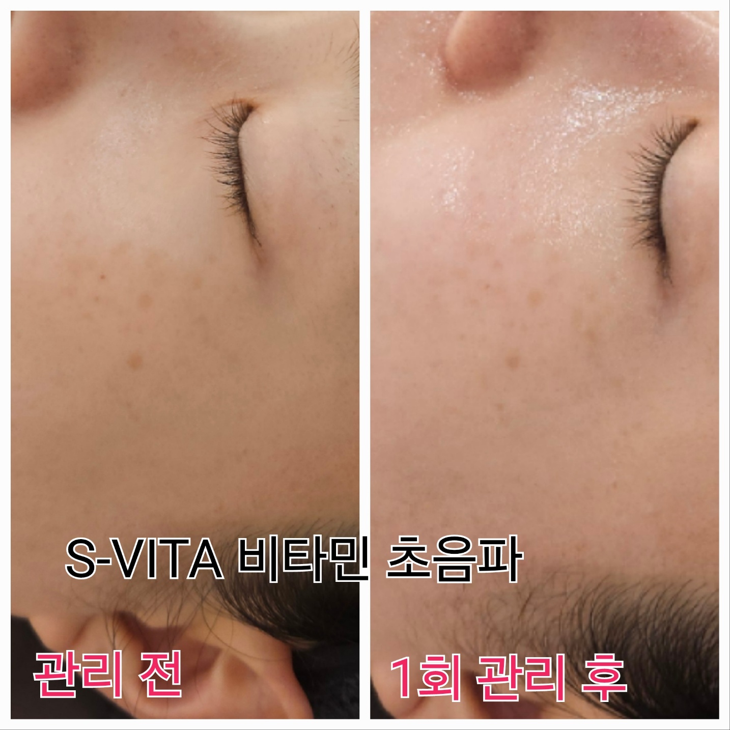 올가드림뷰티 건대입구자양점 대표 이미지