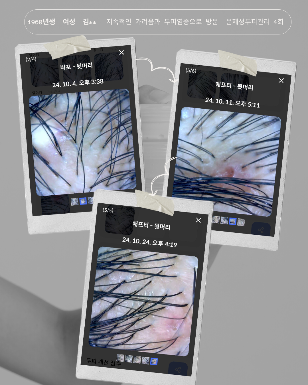 모스테틱 남양주점