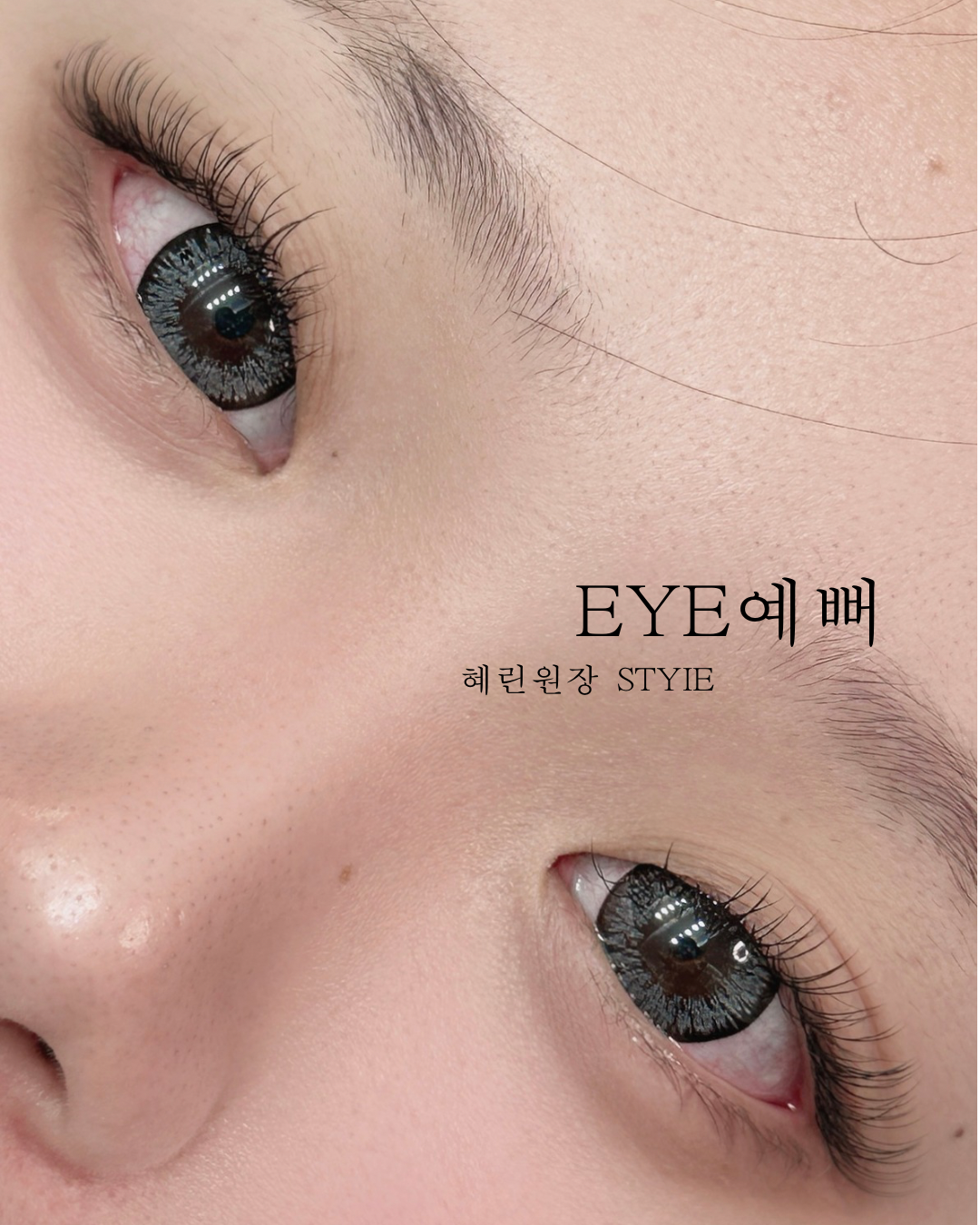 아이예뻐