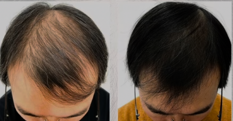 모리셋두피재생센터 창원점 대표 이미지