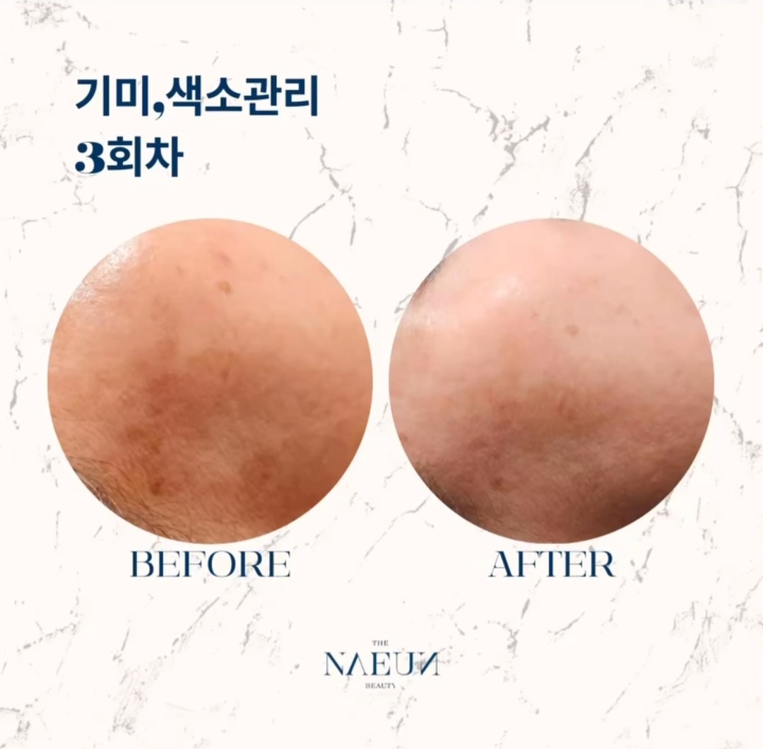 더나은뷰티 대표 이미지