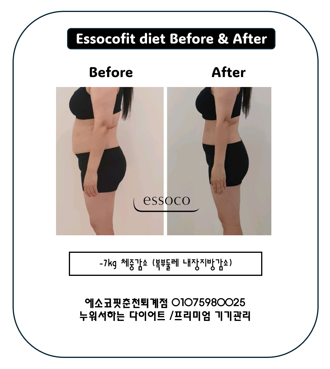 에소코핏 춘천퇴계점