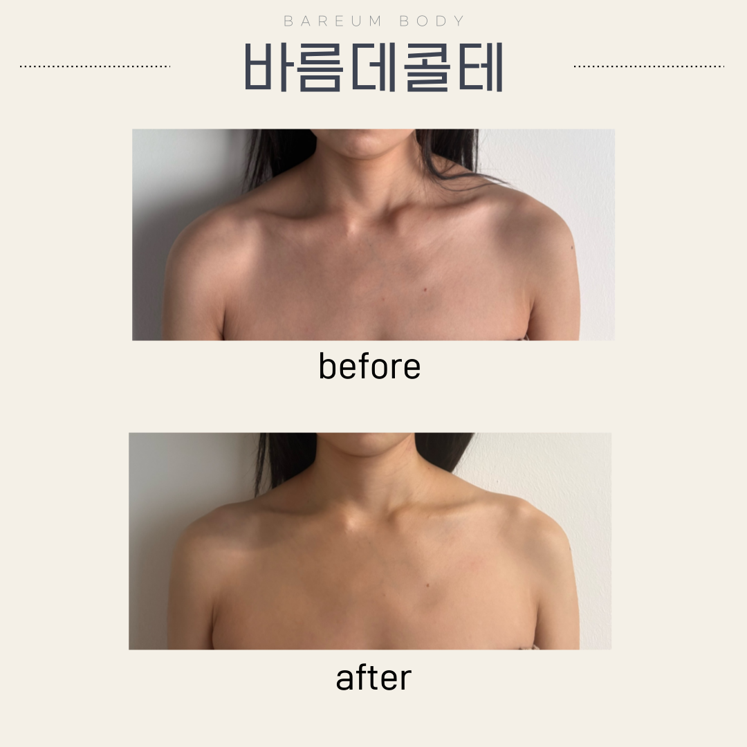 바름바디케어