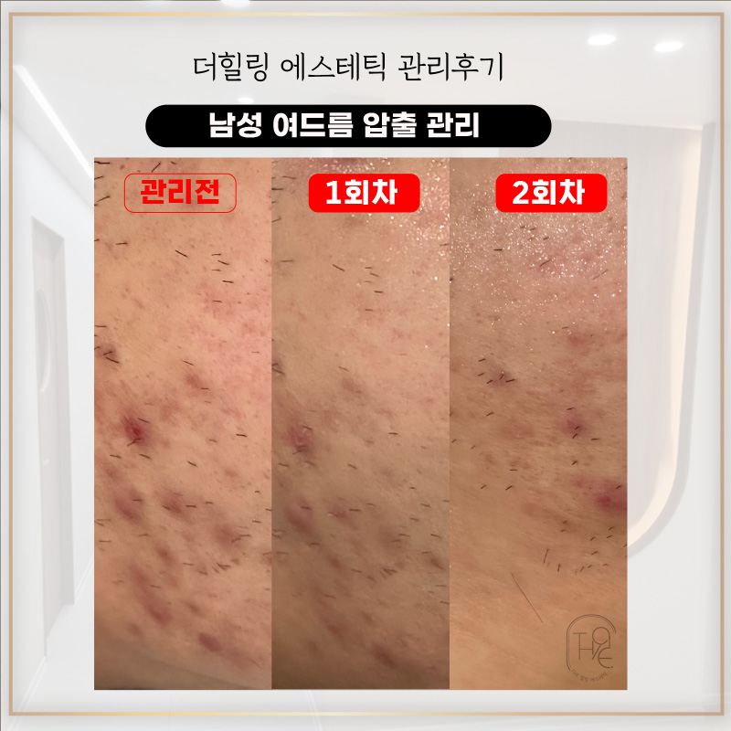 더 힐링 에스테틱