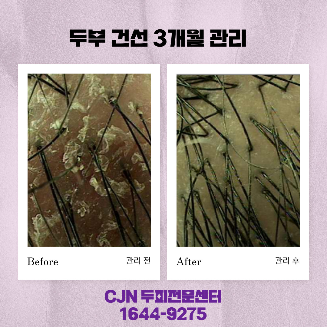 CJN 두피탈모센터 대표 이미지