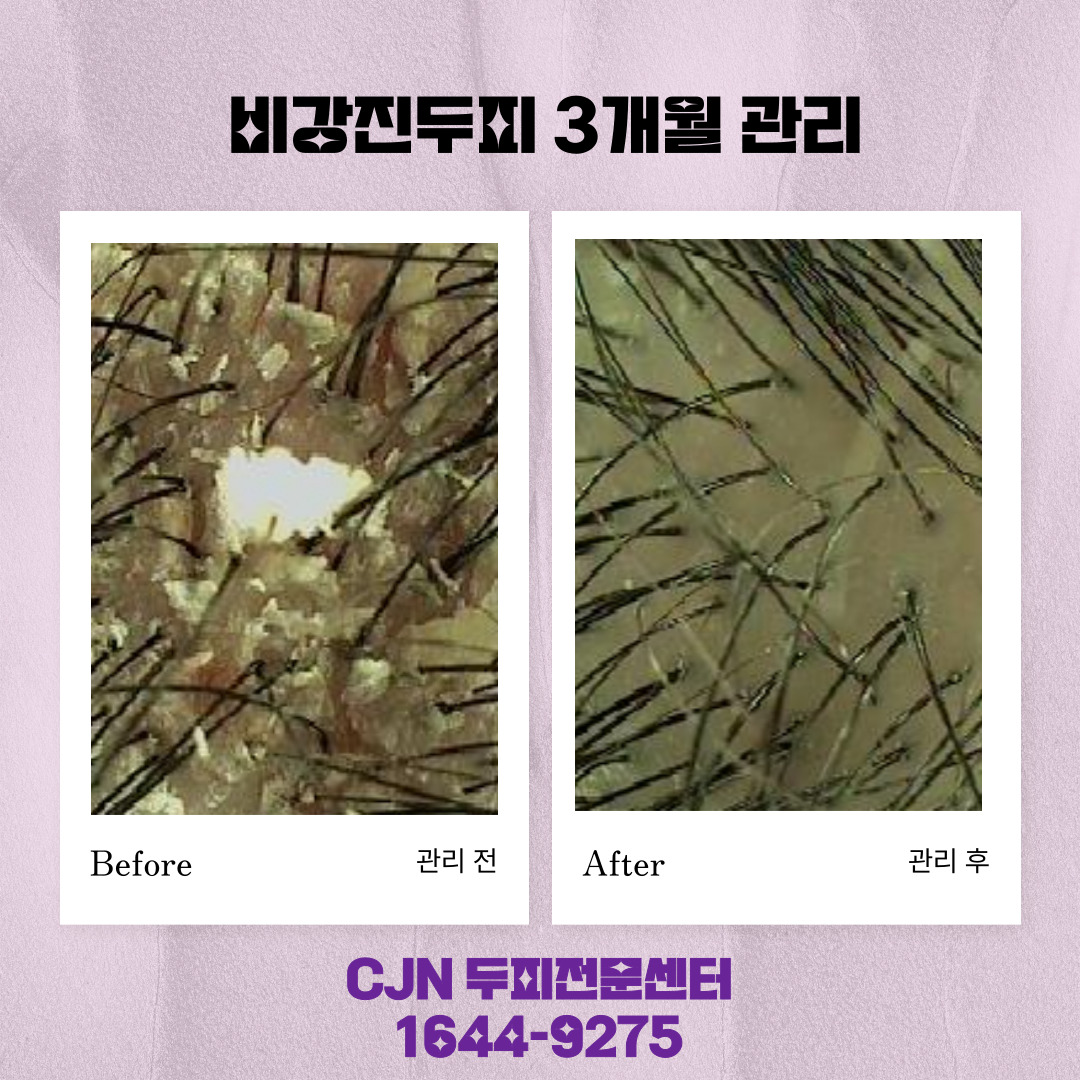 씨제이앤 대표 이미지