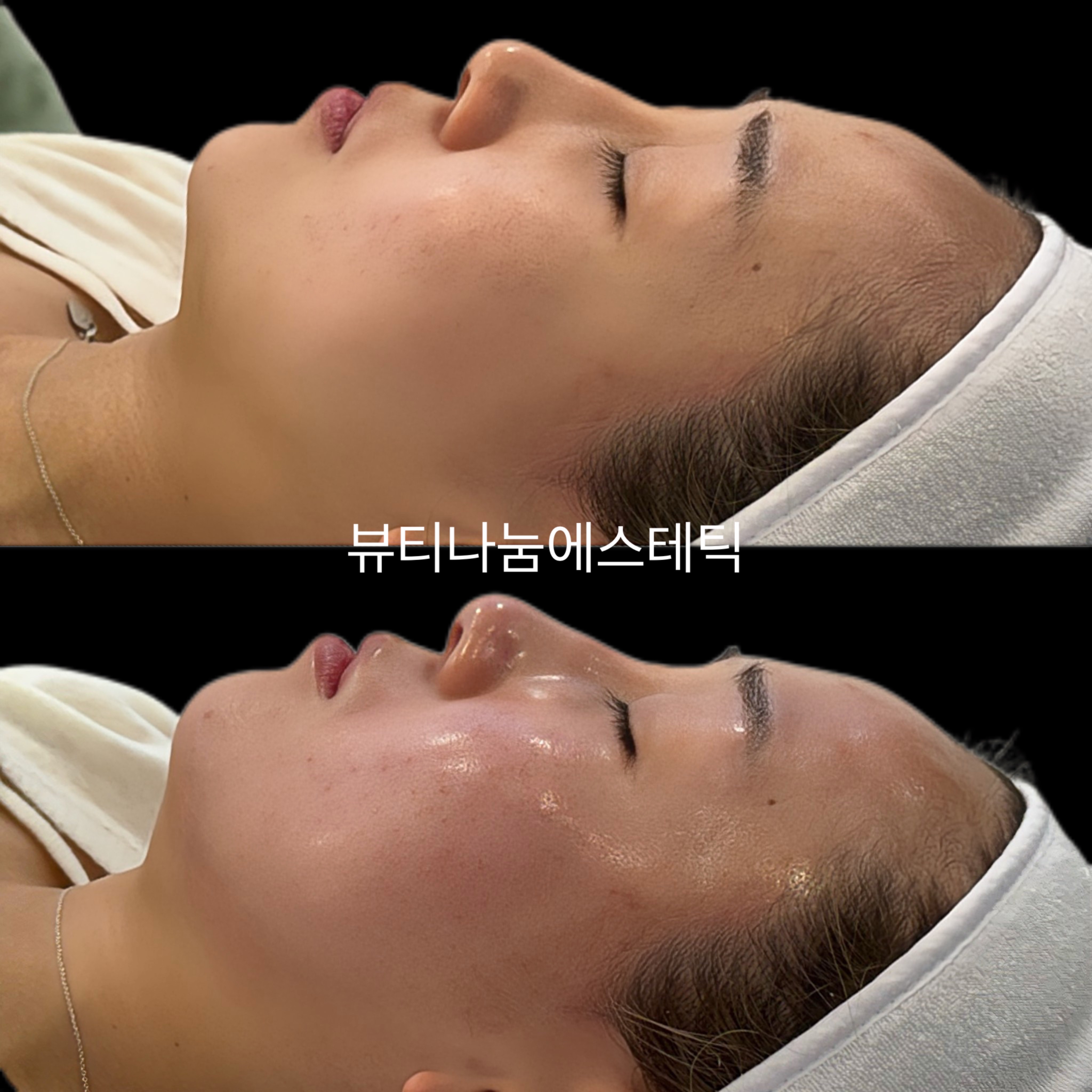 뷰티나눔에스테틱
