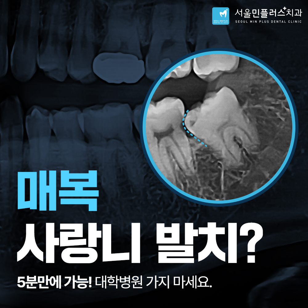 서울민플러스치과 대표 이미지